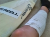 Samuels_injury