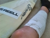Samuels_injury